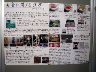 ポスター発表
